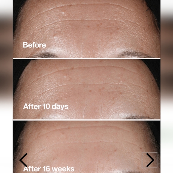 CLINIQUE Smart Clinical Repair Wrinkle Correcting Serum - Picture 3 of 12